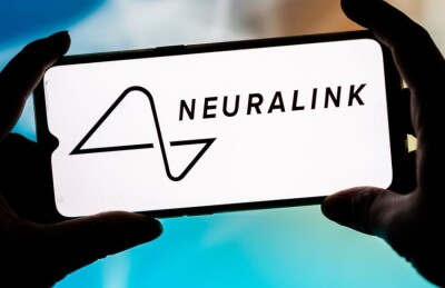 Компанія Маска Neuralink вперше вживила імплант у мозок людини