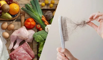 Лікар назвав продукти, через які випадає волосся: 99% людей їдять це щодня